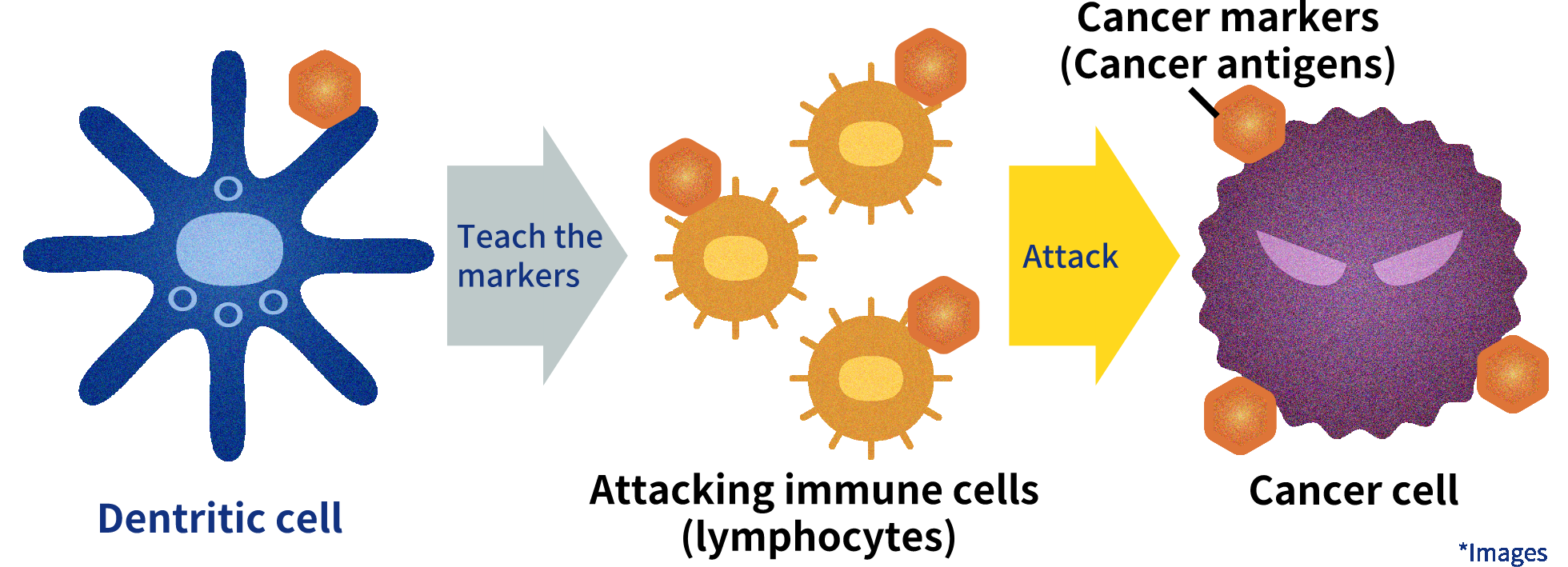 Dendritic cells present cancer markers to immune cells. Immune cells (lymphocytes) attack cancer cells.