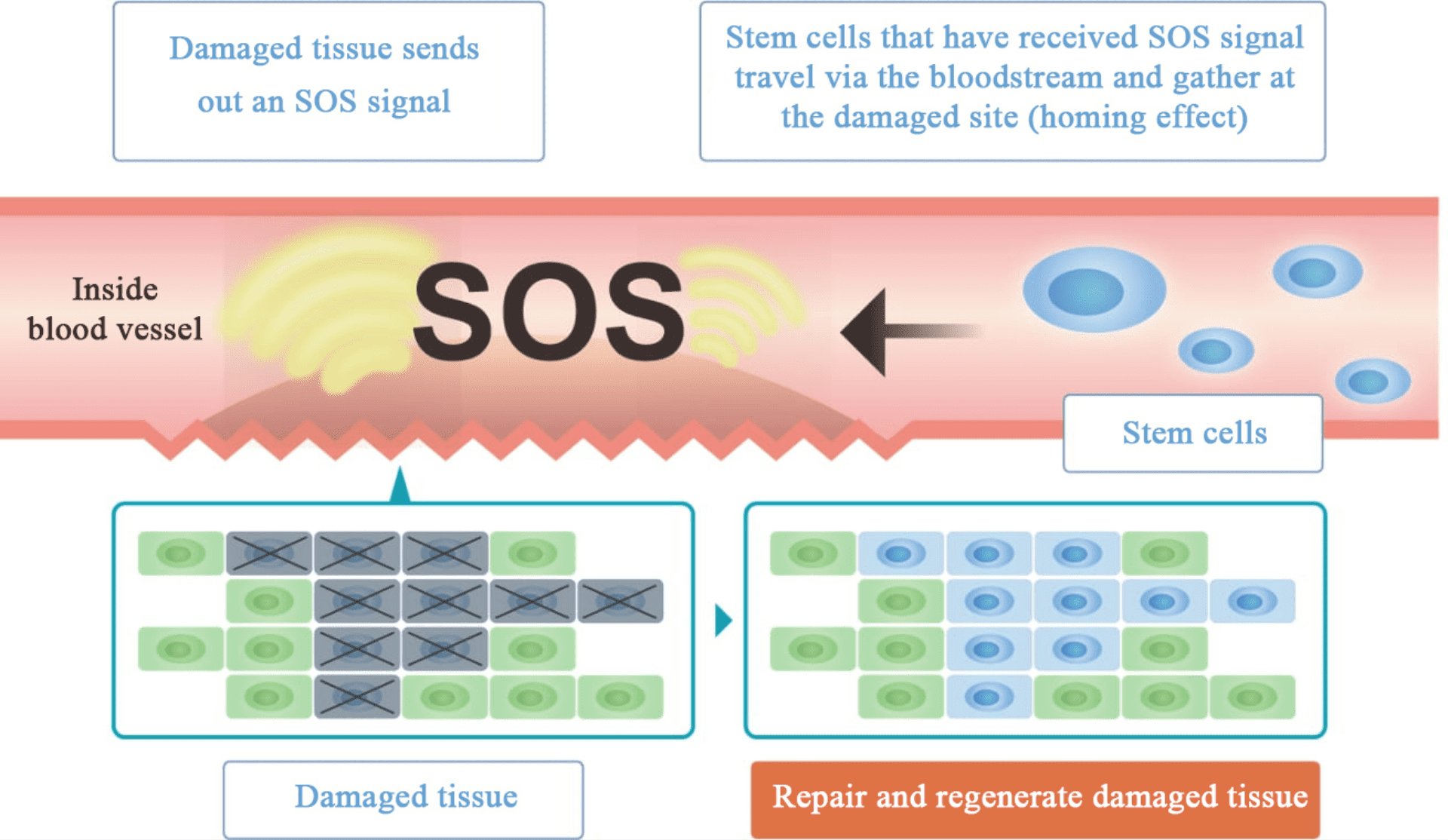 Damaged tissue sends out an SOS signal. Stem cells that have received SOS signal travel via the bloodstream and gather at the damaged site(homing effect). Repair and regenerate damaged tissue.