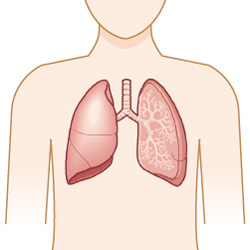 肺癌（がん）