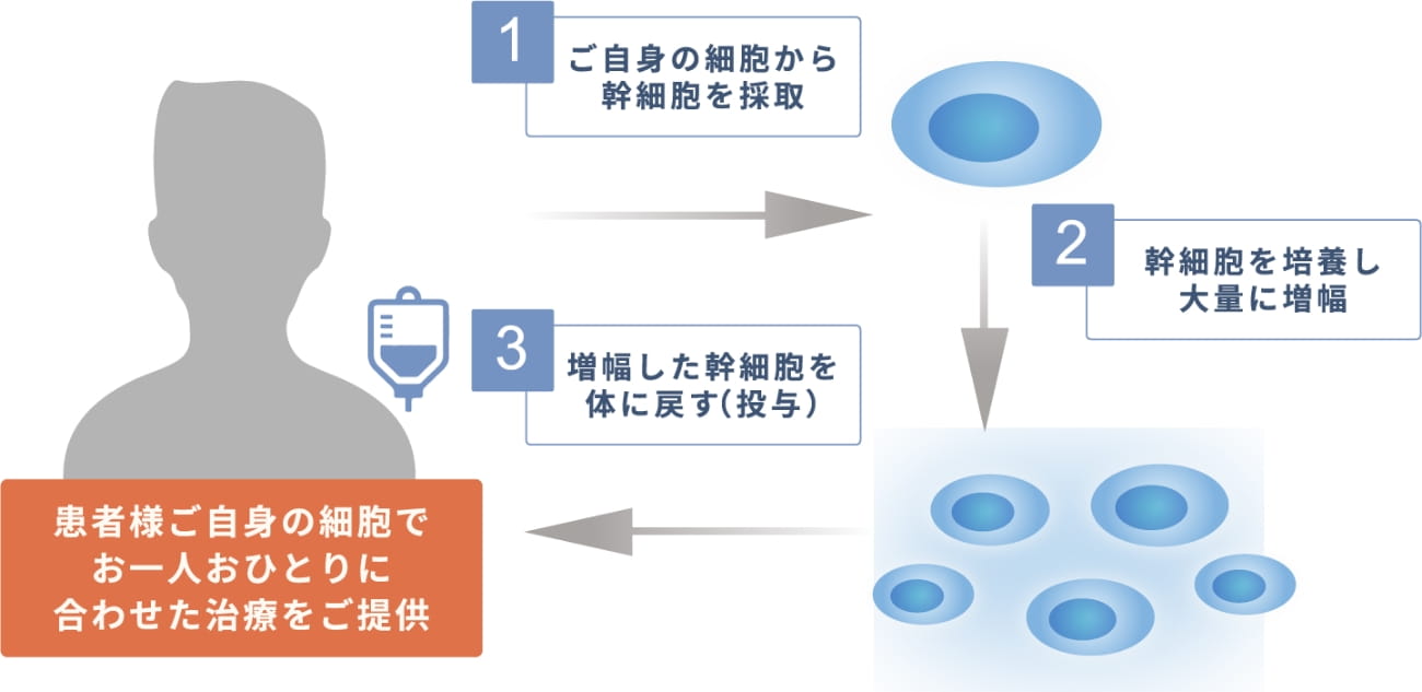 オーダーメイド幹細胞治療