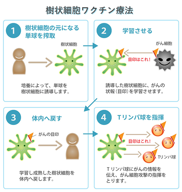 樹状細胞ワクチン療法 ①樹状細胞の元になる単球を搾取 培養によって、単球を樹状細胞に誘導します。 ②学習させる 誘導した樹状細胞に、がんの情報(目印)を学習させます。 ③体内へ戻す 学習し成熟した樹状細胞を体内へ戻します。 ④Tリンパ球を指揮 Tリンパ球にがんの情報を伝え、がん細胞攻撃の指揮をとります。