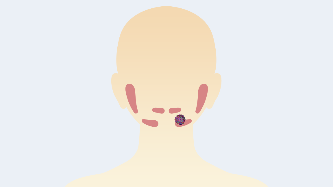 唾液腺がんイメージ
